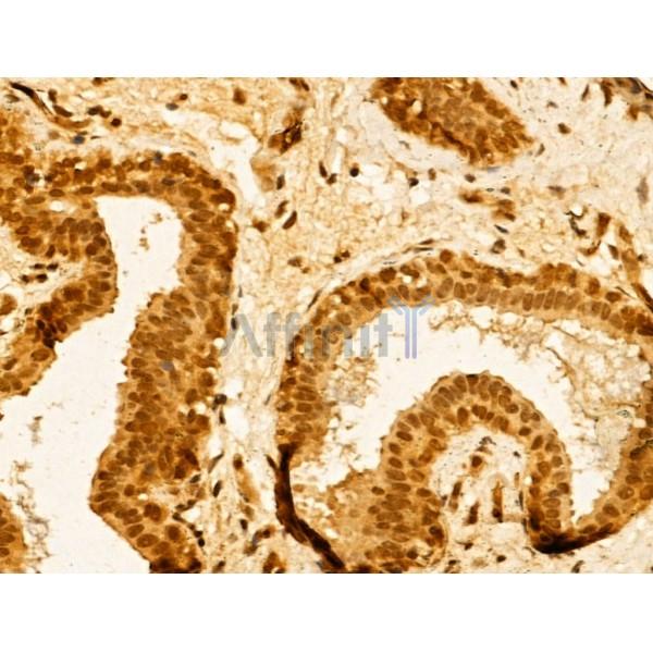TIA1 Antibody - DF12176 at 1/100 staining Human normal tissues adjacent to mammary cancer by IHC-P.