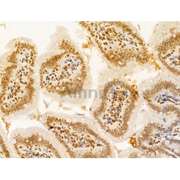 TIA1 Antibody - DF12176 at 1/100 staining Mouse colon tissue by IHC-P.