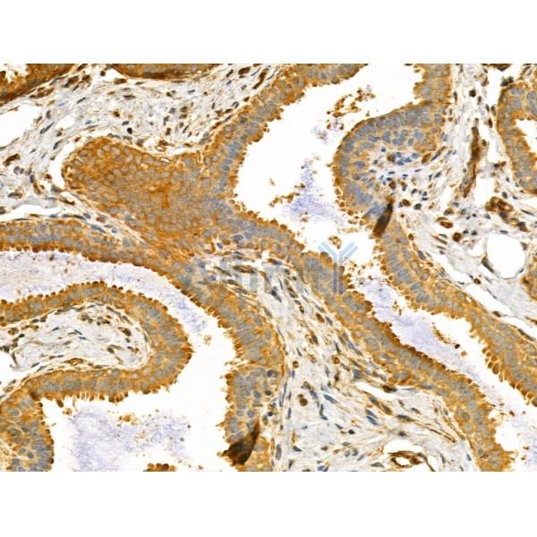 TTLL6 Antibody - DF12178 at 1/100 staining Human normal tissues adjacent to mammary cancer by IHC-P.