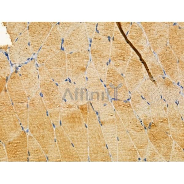 TTLL6 Antibody - DF12178 at 1/100 staining Rat muscle tissue by IHC-P.