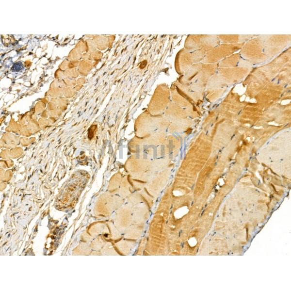 TTLL6 Antibody - DF12178 at 1/100 staining Mouse skin tissue by IHC-P.