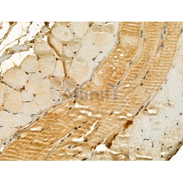 UQCRB Antibody - DF12179 at 1/100 staining Mouse skin tissue by IHC-P.