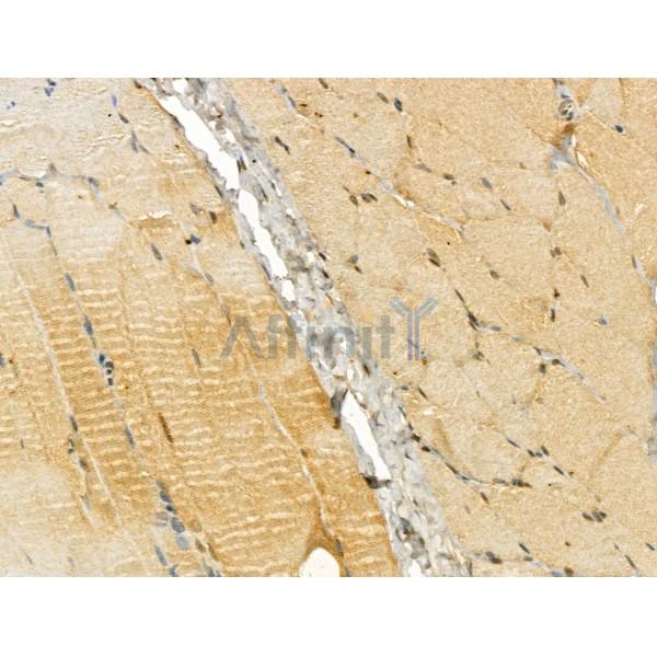 UQCRB Antibody - DF12179 at 1/100 staining Rat skin tissue by IHC-P.