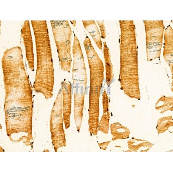 VPS33B Antibody - DF12181 at 1/100 staining Rat skin tissue by IHC-P.