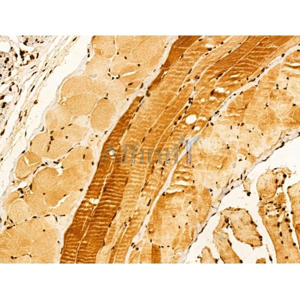 VPS33B Antibody - DF12181 at 1/100 staining Mouse skin tissue by IHC-P.