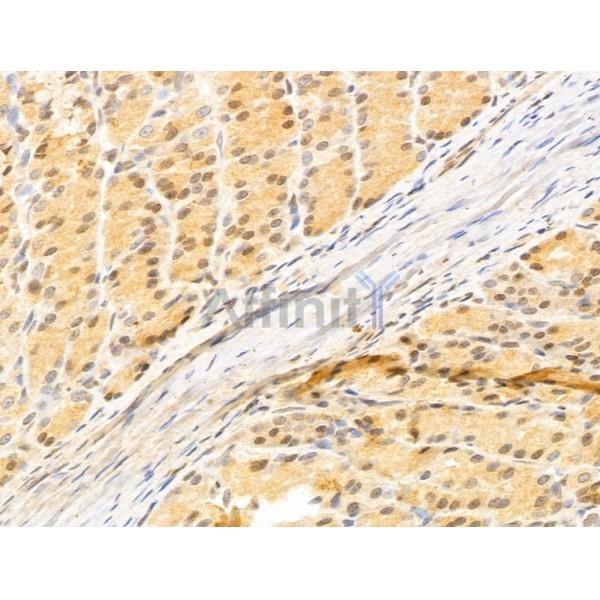 ZCCHC11 Antibody - DF12183 at 1/100 staining Rat stomach tissue by IHC-P.