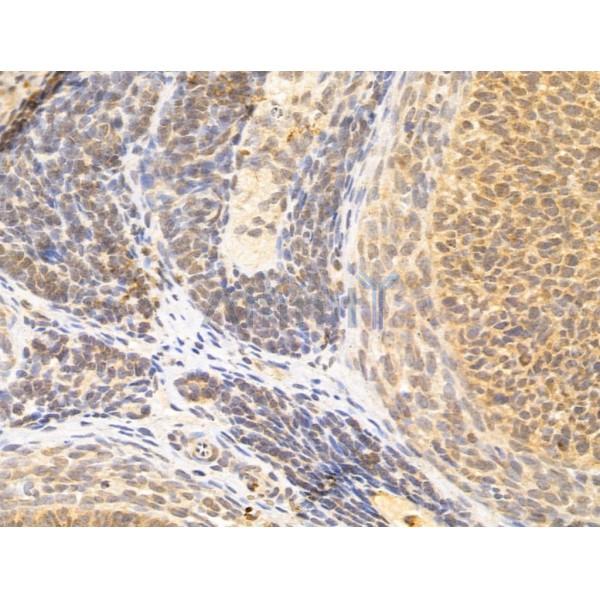 ZCCHC11 Antibody - DF12183 at 1/100 staining Rat ovary tissue by IHC-P.
