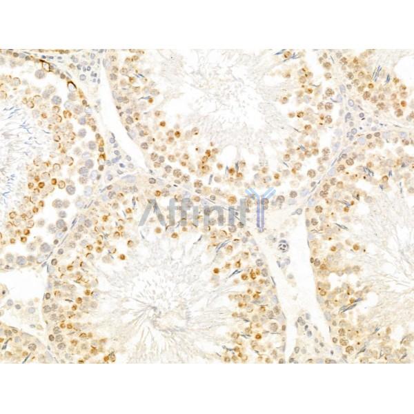 ZCCHC11 Antibody - DF12183 at 1/100 staining Rat testis tissue by IHC-P.