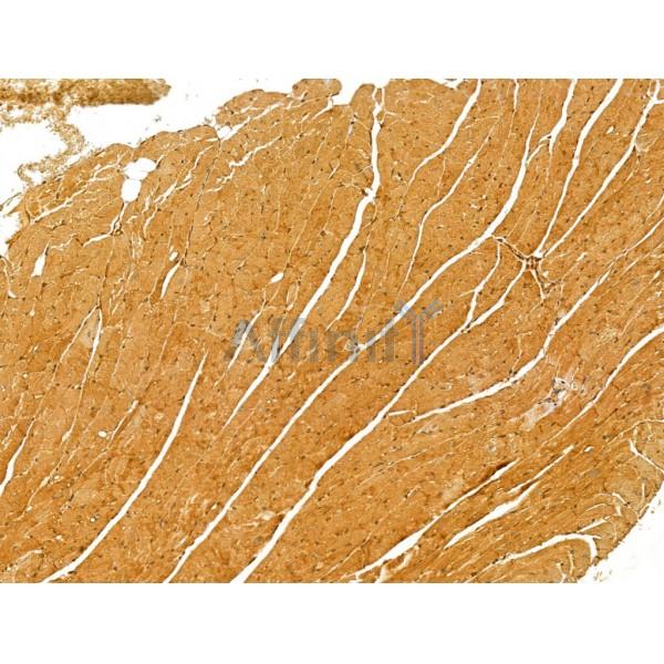 BCS1L Antibody - DF12189 at 1/100 staining Mouse heart tissue by IHC-P.
