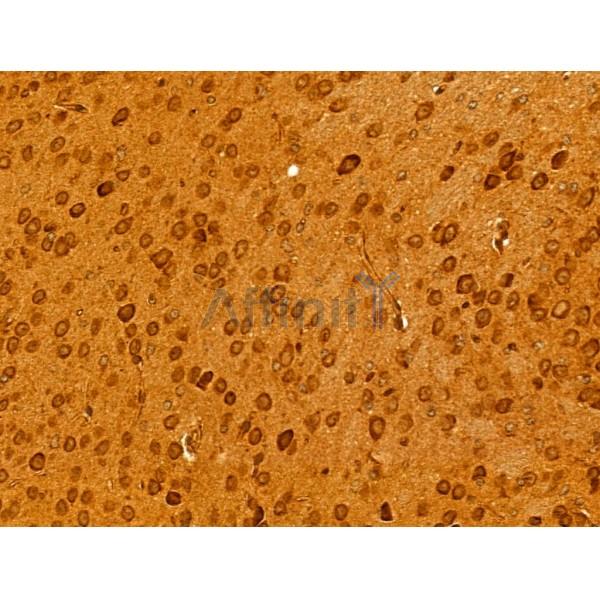 BCS1L Antibody - DF12189 at 1/100 staining Mouse brain tissue by IHC-P.