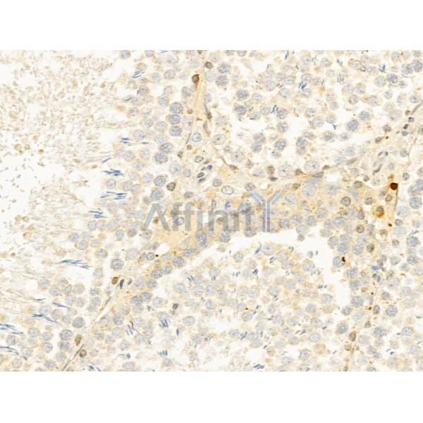 CYLD Antibody - DF12193 at 1/100 staining Rat testis tissue by IHC-P.