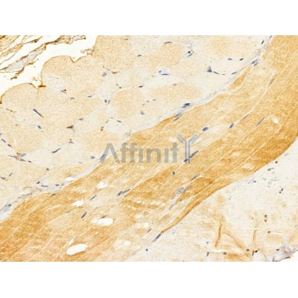 CYLD Antibody - DF12193 at 1/100 staining Mouse skin tissue by IHC-P.