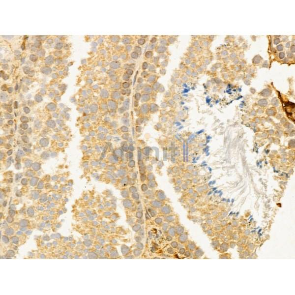 CYLD Antibody - DF12193 at 1/100 staining Mouse testis tissue by IHC-P.