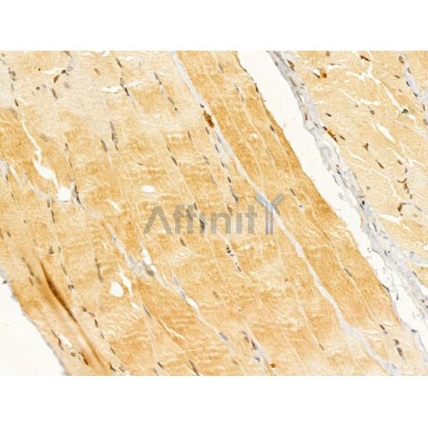 CYLD Antibody - DF12193 at 1/100 staining Rat skin tissue by IHC-P.