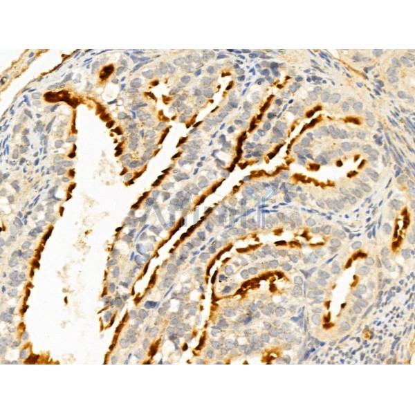 ERO1LB Antibody - DF12199 at 1/100 staining Mouse ovary tissue by IHC-P.