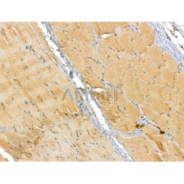 ETFB Antibody - DF12200 at 1/100 staining Rat skin tissue by IHC-P.