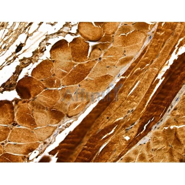 EXOC1 Antibody - DF12201 at 1/100 staining Mouse skin tissue by IHC-P.