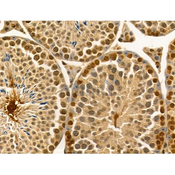 LARP7 Antibody - DF12208 at 1/100 staining Mouse testis tissue by IHC-P.