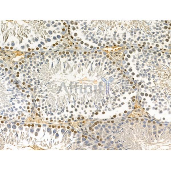 LARP7 Antibody - DF12208 at 1/100 staining Rat testis tissue by IHC-P.