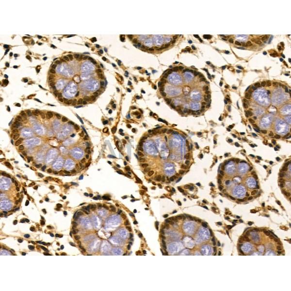 LARP7 Antibody - DF12208 at 1/100 staining Human normal tissues adjacent to colorectal cancer by IHC-P.