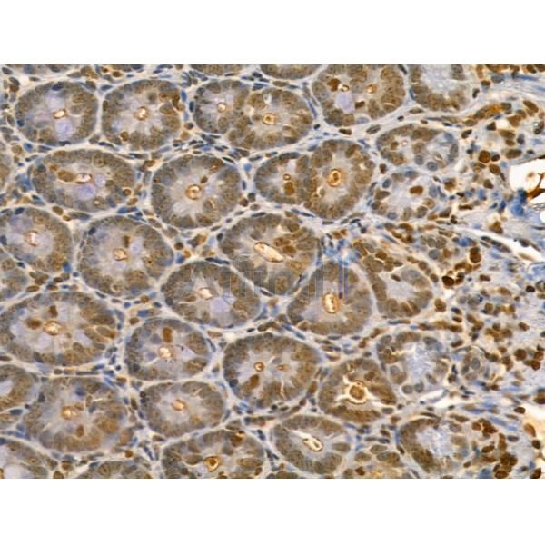 LARP7 Antibody - DF12208 at 1/100 staining Rat colon tissue by IHC-P.