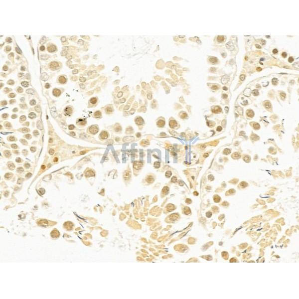 MMS19 Antibody - DF12212 at 1/100 staining Rat testis tissue by IHC-P.