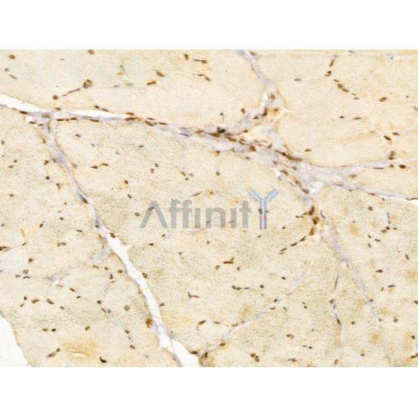 OIP5 Antibody - DF12217 at 1/100 staining Rat skin tissue by IHC-P.