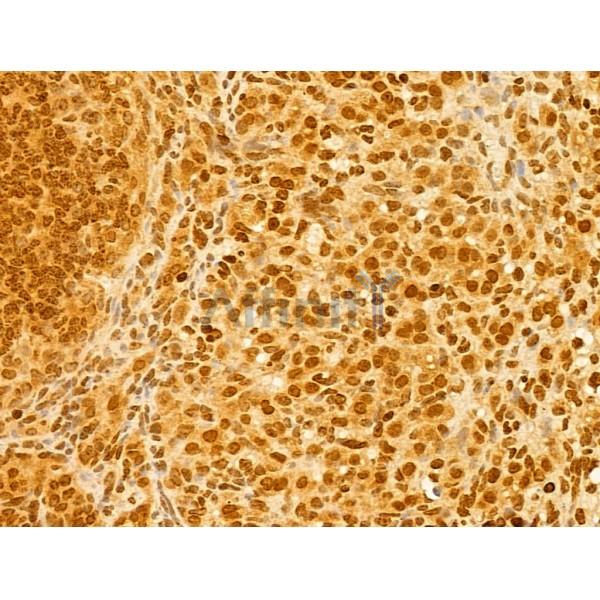 OIP5 Antibody - DF12217 at 1/100 staining Mouse ovary tissue by IHC-P.