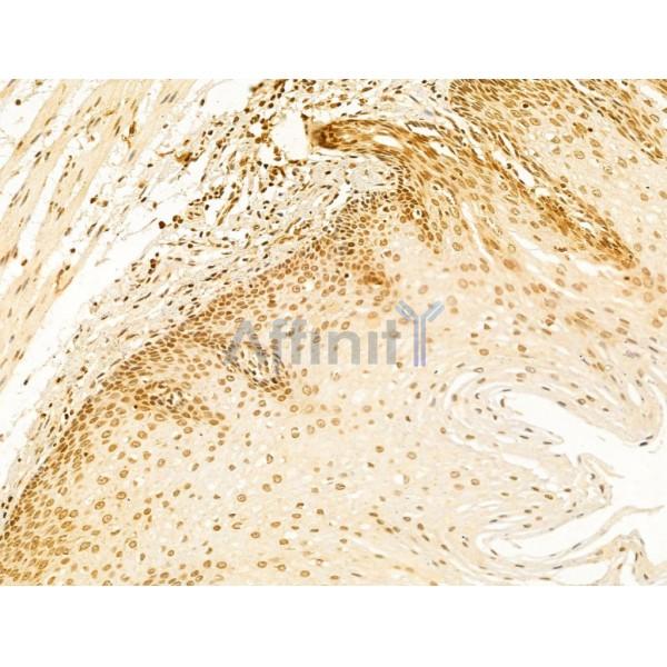 OIP5 Antibody - DF12217 at 1/100 staining Human normal tissues adjacent to esophageal cancer by IHC-P.