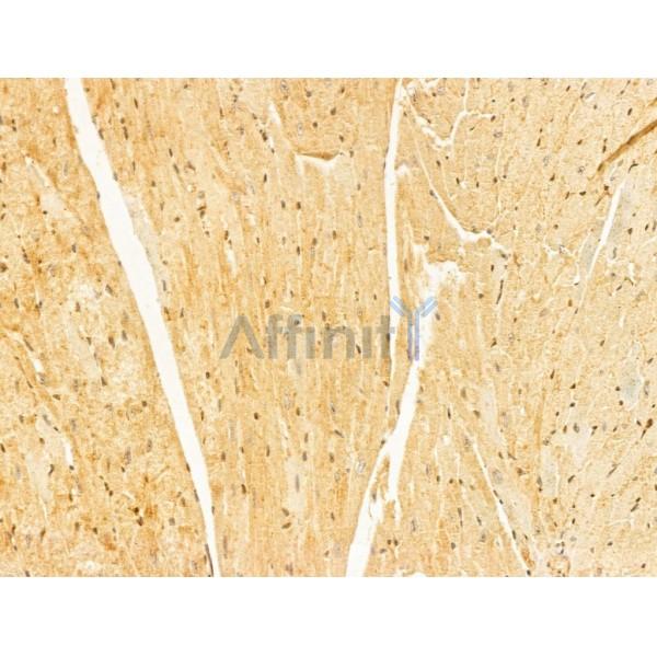 OIP5 Antibody - DF12217 at 1/100 staining Mouse heart tissue by IHC-P.