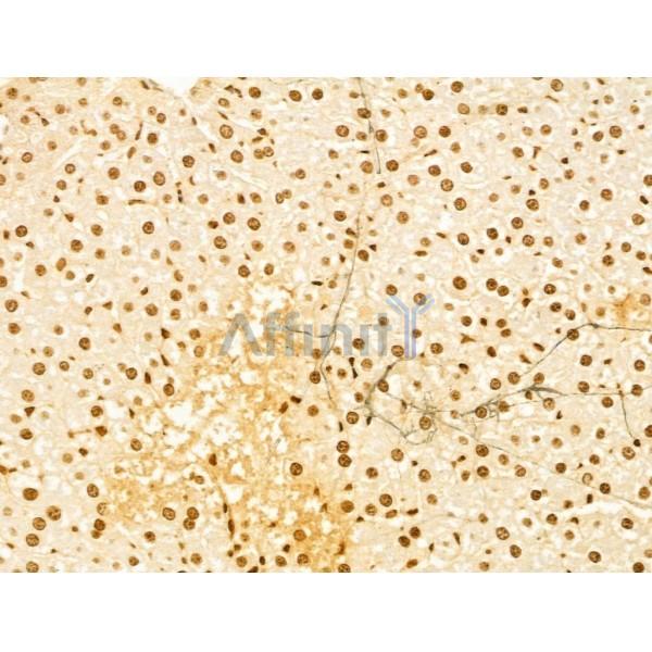 OTUD7B Antibody - DF12218 at 1/100 staining Rat liver tissue by IHC-P.