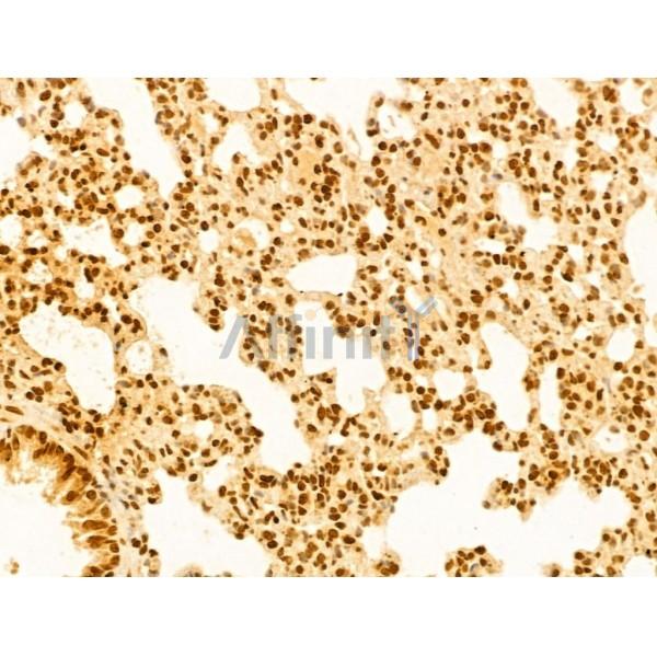 OTUD7B Antibody - DF12218 at 1/100 staining Rat lung tissue by IHC-P.