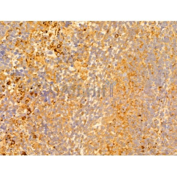 P4HA1 Antibody - DF12219 at 1/100 staining Rat spleen tissue by IHC-P.