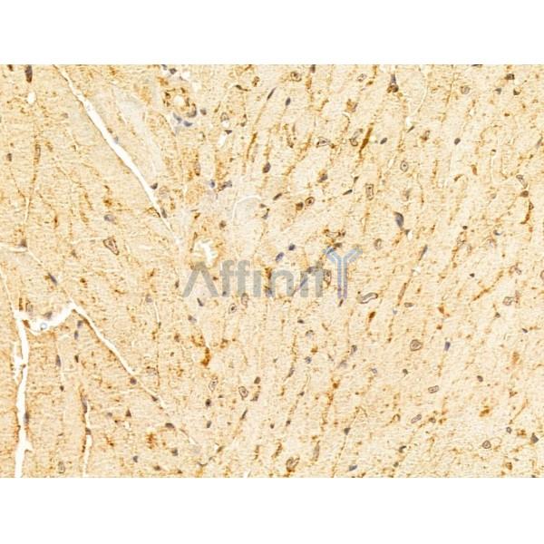 VPS11 Antibody - DF12500 at 1/100 staining Mouse heart tissue by IHC-P.