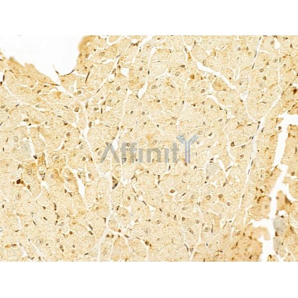 VPS11 Antibody - DF12500 at 1/100 staining Rat heart tissue by IHC-P.