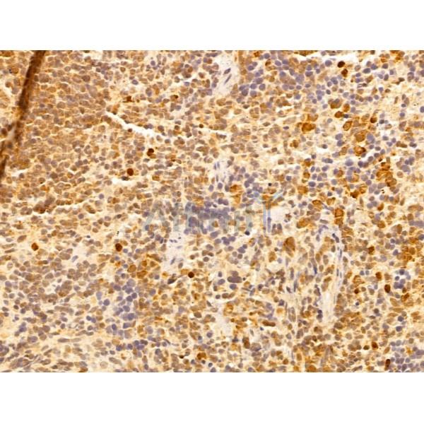 WDR18 Antibody - DF12502 at 1/100 staining Rat spleen tissue by IHC-P.