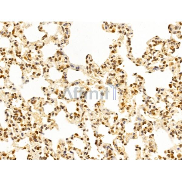 WDR18 Antibody - DF12502 at 1/100 staining Rat lung tissue by IHC-P.