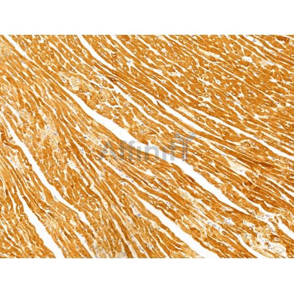 FAM92A1 Antibody - DF13000 at 1/100 staining Rat heart tissue by IHC-P.