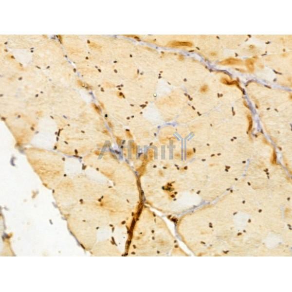 FBXL14 Antibody - DF13005 at 1/100 staining Rat skin tissue by IHC-P.