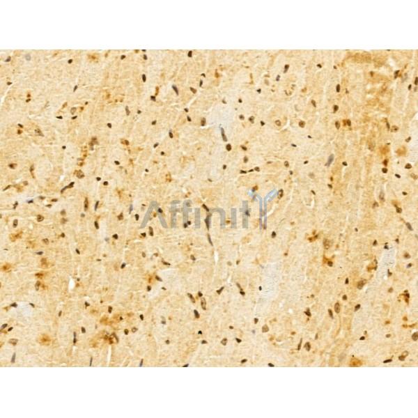 FBXL14 Antibody - DF13005 at 1/100 staining Mouse heart tissue by IHC-P.