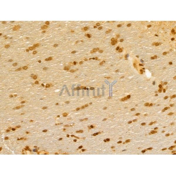 FBXL14 Antibody - DF13005 at 1/100 staining Rat brain tissue by IHC-P.