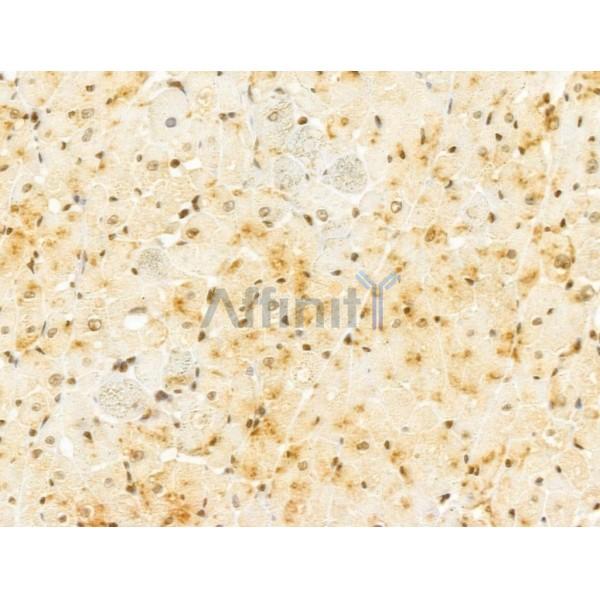 FBXL14 Antibody - DF13005 at 1/100 staining Rat heart tissue by IHC-P.