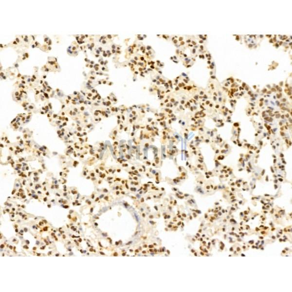 FBXL14 Antibody - DF13005 at 1/100 staining Rat lung tissue by IHC-P.