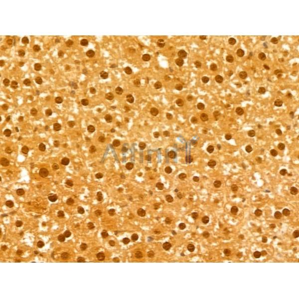 FBXL14 Antibody - DF13005 at 1/100 staining Rat liver tissue by IHC-P.