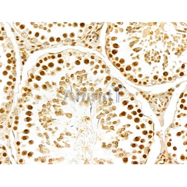 FBXL14 Antibody - DF13005 at 1/100 staining Rat testis tissue by IHC-P.