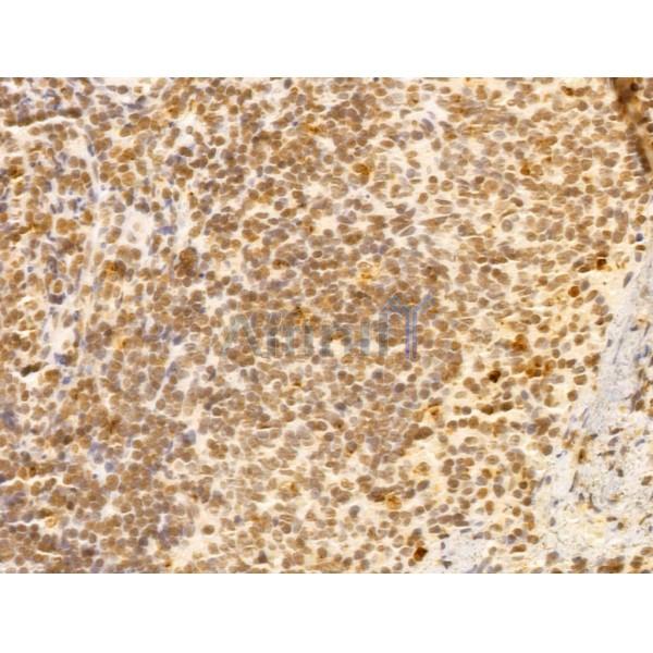 FBXL14 Antibody - DF13005 at 1/100 staining Rat spleen tissue by IHC-P.