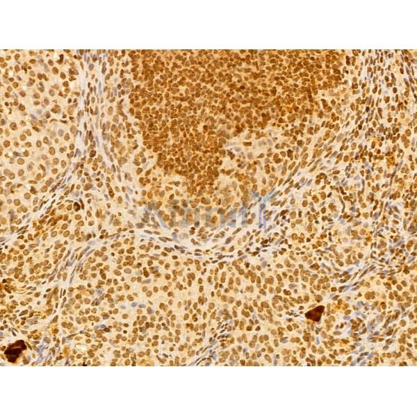 FBXL14 Antibody - DF13005 at 1/100 staining Mouse ovary tissue by IHC-P.