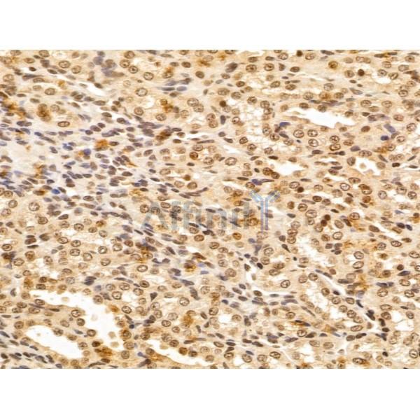 FBXL14 Antibody - DF13005 at 1/100 staining Rat kidney tissue by IHC-P.