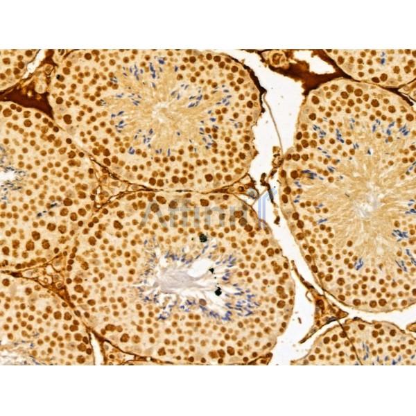 FBXL14 Antibody - DF13005 at 1/100 staining Mouse testis tissue by IHC-P.