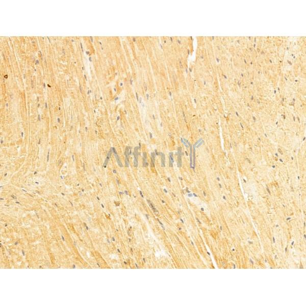 FBXO17 Antibody - DF13006 at 1/100 staining Mouse heart tissue by IHC-P.